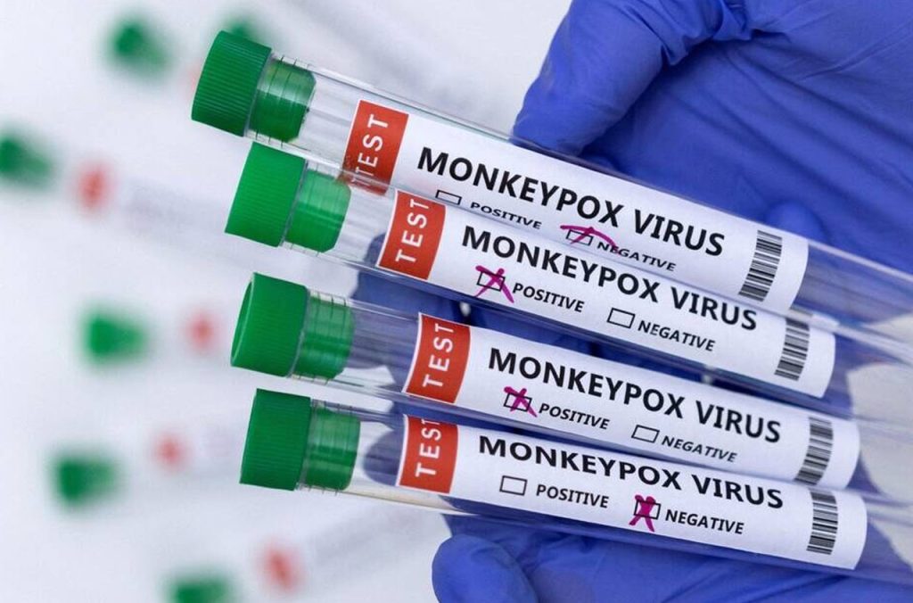 Mpox : l'épidémie de la variole du singe en Algérie, en Afrique et à travers le Monde